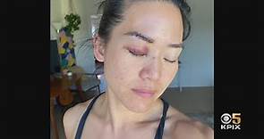 Brutal 'Survivor' Attack: Former 'Survivor' contestant Michelle Yi talks about a vicious attack