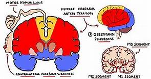 Middle Cerebral Artery Stroke Syndromes | MCA Stroke Syndromes (With Gerstmann Syndrome & Lesions!)