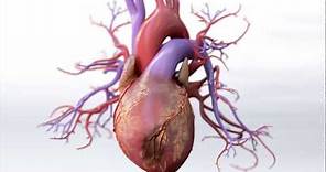 What is Coronary Artery Disease - Mechanism of Disease