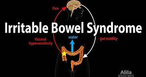 Irritable Bowel Syndrome: Pathophysiology, Symptoms, Causes, Diagnosis and Treatment, Animation