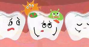 一个动画告诉你：蛀牙的形成与危害