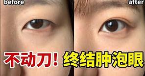 3分鐘消除眼皮肥厚| 眼皮浮腫 日本雙眼皮操get深邃大眼