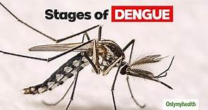 Dengue: Know About The Various Stages Of Dengue And Its Symptoms