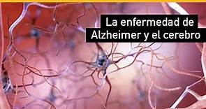 Cómo cambia la enfermedad de Alzheimer al cerebro