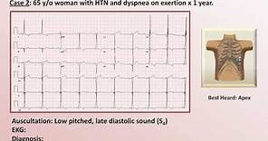 EKG and Heart Murmur Review - Part 1