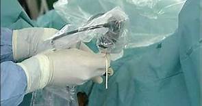 ¿Cómo se realiza una Ureteroscopia Flexible? - Coloplast