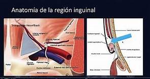 ECOGRAFIA EN LAS HERNIAS DE PARED ABDOMINAL Y ANILLO INGUINAL