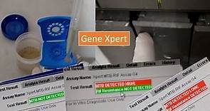 GeneXpert introduction, procedure and its application