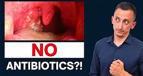 Antibiotics for Strep Throat: Do We Need Them?