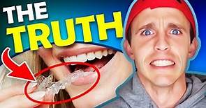 Orthodontist REVIEW of Smile Direct Club..**Watch BEFORE you buy!!**