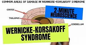 2-Minute Neuroscience: Wernicke-Korsakoff Syndrome