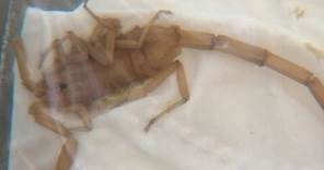 Arizona mother shares boy's severe reaction to scorpion sting