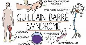 Understanding Guillain-Barré Syndrome