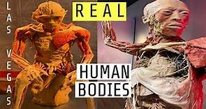 REAL & PRESERVED Human Bodies Exhibit at Bally’s Hotel Las Vegas