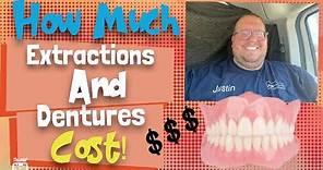 How much dentures cost! Going over pricing. Affordable and Aspen prices!