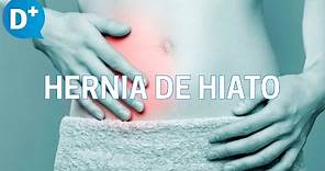 Hernia de hiato: Causas, síntomas y tratamiento de la hernia de hiato