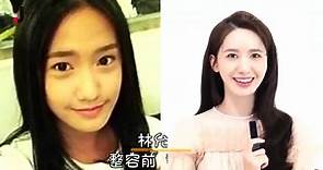 南韩女星整容前后，李多海数次修整变脸回春，林允儿削骨逆袭女神