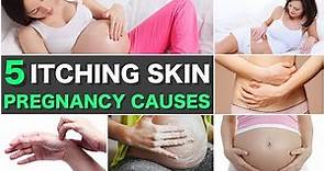 5 Causes of Itching Skin in Pregnancy and Treatments