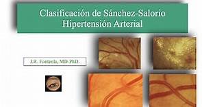 Clasificación de Sánchez Salorio. Hipertensión Arterial.