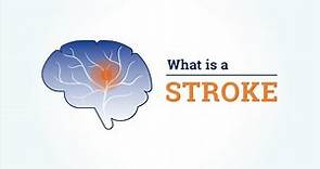 What is a stroke? What are the different types of strokes?