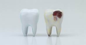 牙醫師圖解說明：牙齒掉落、斷裂怎麼辦？有可能把牙齒「種」回去嗎？ - The News Lens 關鍵評論網