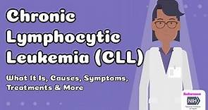 Chronic Lymphocytic Leukemia (CLL) - What It Is, Causes, Symptoms, Treatments & More
