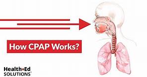 One Quick Question: How Does CPAP Work?