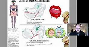 Essex-Lopresti Classification of Calcaneal Fractures