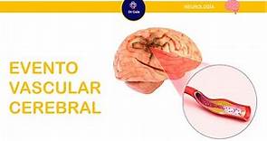Evento Vascular Cerebral (#ParaelENARM)