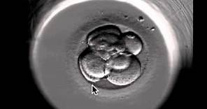 ivf embryo developing over 5 days by fertility Dr Raewyn Teirney