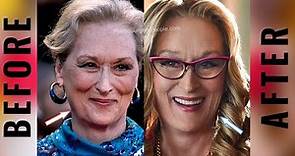 Meryl Streep Before And After Plastic Surgery
