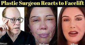Plastic Surgeon Reacts | Lorry Hill's Facelift Before & After
