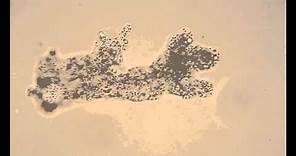 Live Amoeba proteus showing amoeboid movement