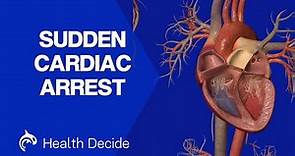 Cardiac Arrest (Sudden Death) - 3D Animation