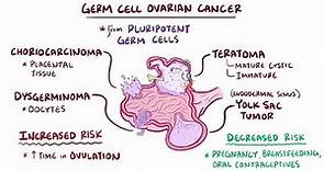 Germ cell ovarian tumors