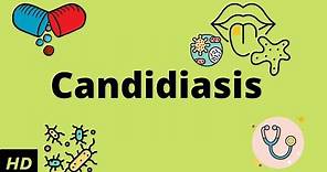 CANDIDIASIS, Causes, Signs and Symptoms, Diagnosis and Treatment.
