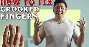 Straighten Your Crooked Fingers With This Simple Trick! | Finger Mobilization By Physical Therapist