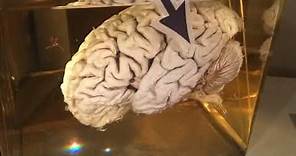 Einstein's brain: A trip to the Mutter Museum in Philadelphia