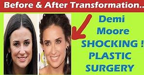 Demi Moore Plastic Surgery Before and After HD