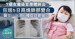 肺炎支原體丨7歲女童染肺炎支原體狂咳高燒肺變白     醫生：出現6種症狀要留心 - 香港經濟日報 - TOPick - 親子 - 兒童健康