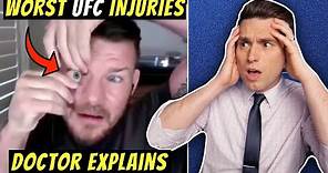 Worst UFC Injuries EVER! Doctor Explains SHOCKING Michael Bisping Eye Injury Story