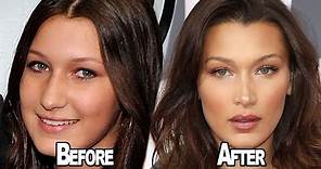 Bella Hadid OPENS UP About Having Plastic Surgery!