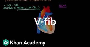 What is ventricle fibrillation (Vfib)? | Circulatory System and Disease | NCLEX-RN | Khan Academy