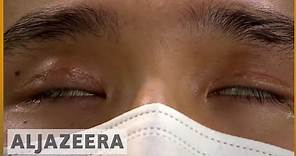 🇨🇳 Changing faces: China's plastic surgery boom | Al Jazeera English