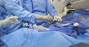 心臟病患者看過來！心臟血管支架、冠狀動脈繞道手術真的有必要嗎？最新跨國研究給出答案-風傳媒