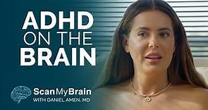 Brielle Biermann: The Impact of ADHD on the Brain