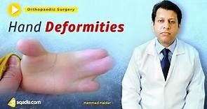 Hand Deformities | Orthopaedic Basic Science Lecture | Student V-Learning | sqadia.com
