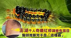 澎湖千人奇癢紅疹原因找到了 衛生局宣布破案！兇手是這隻毛毛蟲 | 台灣新聞 Taiwan 蘋果新聞網