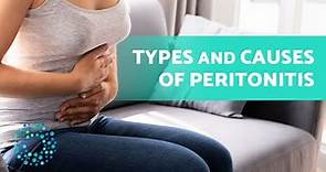PERITONITIS EXPLAINED🫄 (Types, Causes, and Symptoms of this Abdominal Condition)