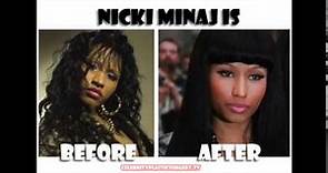 !!Shocking Nicki Minaj Before Plastic Surgery